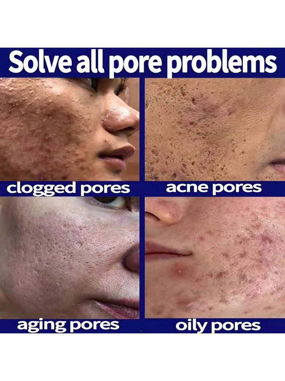 5ml/15ml/30ml/50ml/100ml Pore Control & Skin Tightening Serum, Professional Skin Care for Pore Minimization & Skin