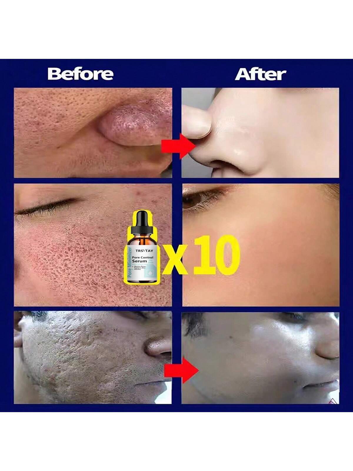 5ml/15ml/30ml/50ml/100ml Pore Control & Skin Tightening Serum, Professional Skin Care for Pore Minimization & Skin